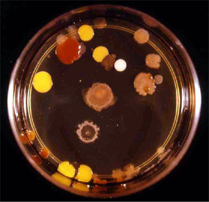 agar nutrient